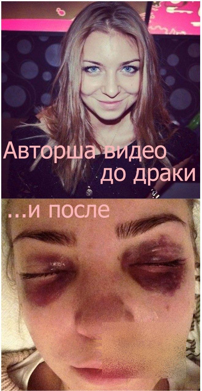 Aşa arată această fată după ce a mers cu trenul. "M-au lovit cu sălbăticie" 235095