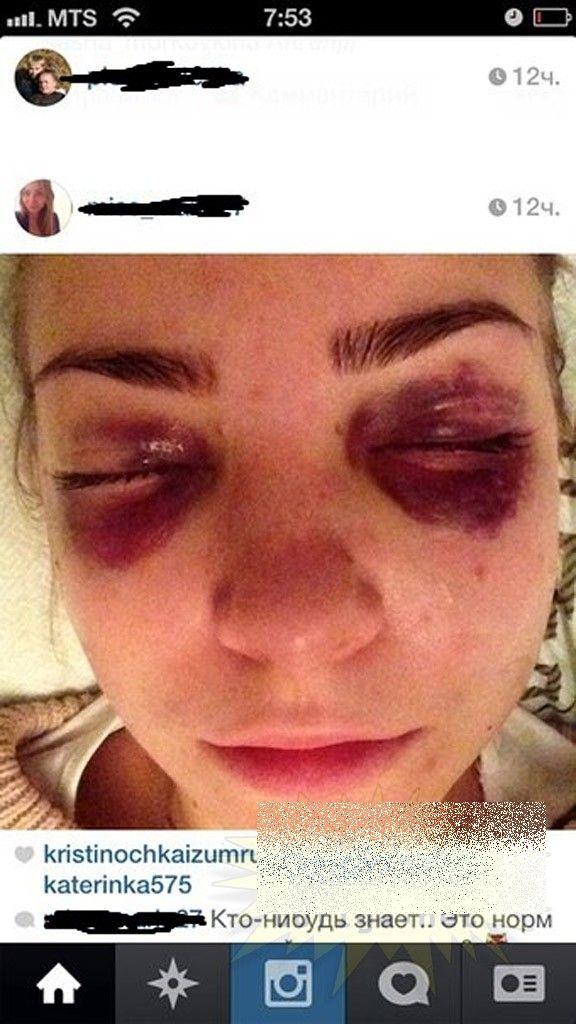 Aşa arată această fată după ce a mers cu trenul. "M-au lovit cu sălbăticie" 235096