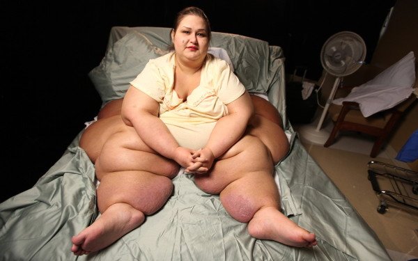 Cum arată femeia care a SLĂBIT 378 de kilograme în 24 de luni. Cântărea aproape jumătate de TONĂ