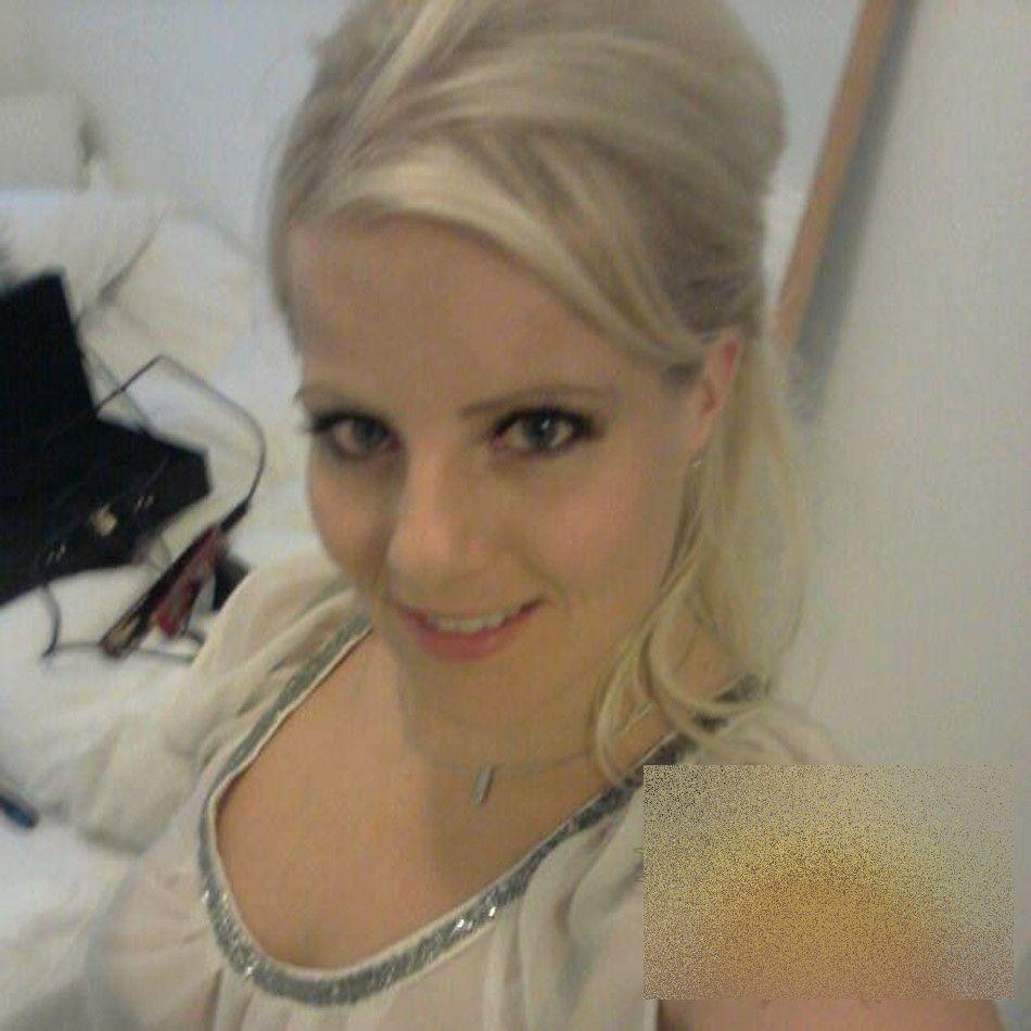 Această tânără a trecut prin coşmarul vieţii ei, după o vizită în Italia. Cum arată după ce a fost muşcată de un păianjen 236071