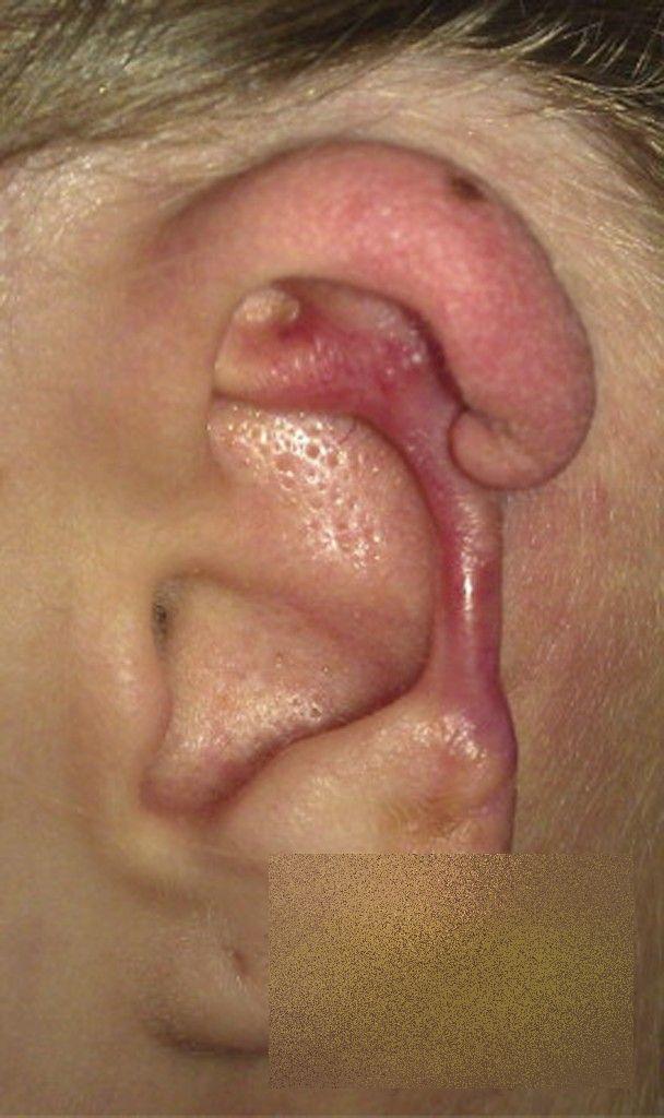 Această tânără a trecut prin coşmarul vieţii ei, după o vizită în Italia. Cum arată după ce a fost muşcată de un păianjen 236077