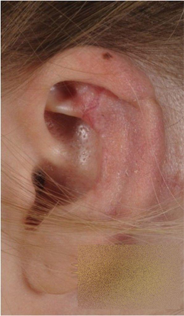 Această tânără a trecut prin coşmarul vieţii ei, după o vizită în Italia. Cum arată după ce a fost muşcată de un păianjen 236078