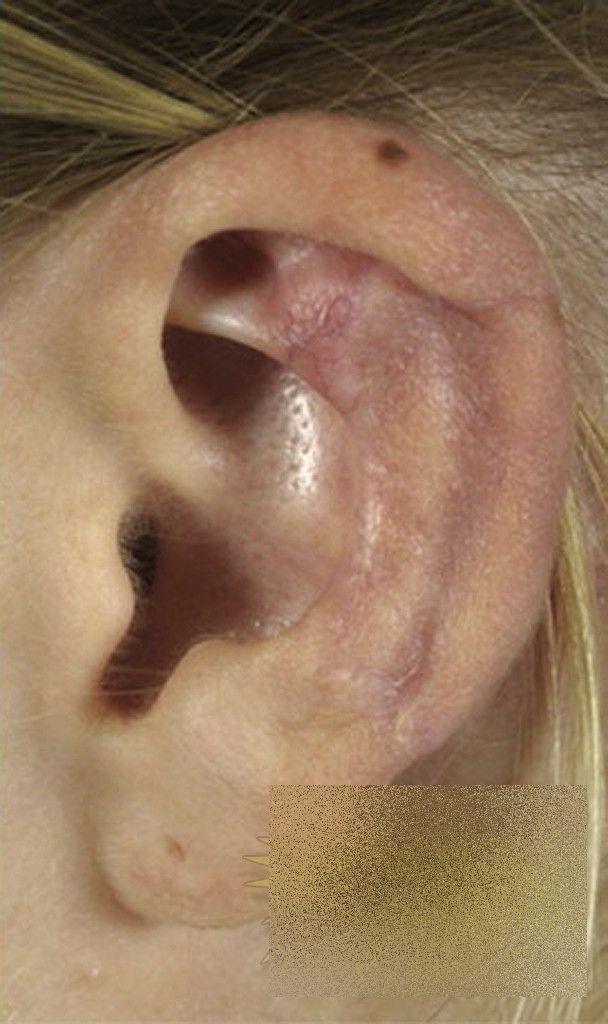 Această tânără a trecut prin coşmarul vieţii ei, după o vizită în Italia. Cum arată după ce a fost muşcată de un păianjen 236079