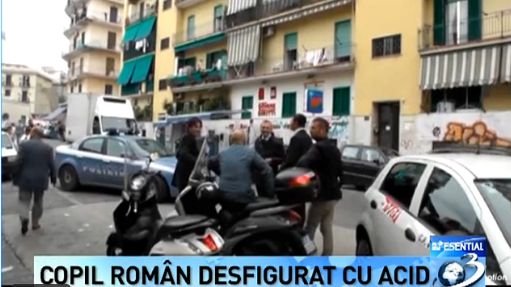 Româncă şi copilul său, atacaţi cu acid în Italia. Micuţul a fost desfigurat de o italiancă