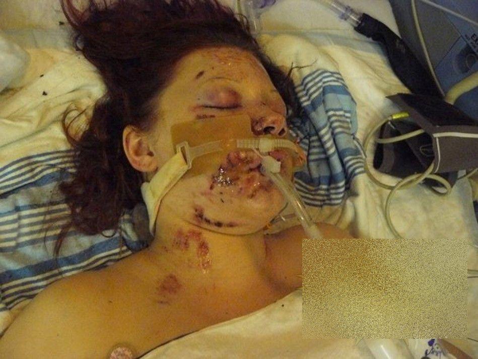 Ce s-a întâmplat cu această adolescentă după ce a consumat droguri. "E un MIRACOL că a supravieţuit" 238153