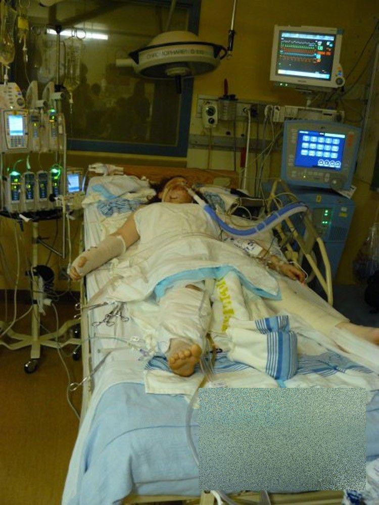 Ce s-a întâmplat cu această adolescentă după ce a consumat droguri. "E un MIRACOL că a supravieţuit" 238154