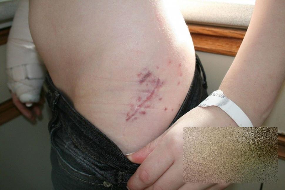 Ce s-a întâmplat cu această adolescentă după ce a consumat droguri. "E un MIRACOL că a supravieţuit" 238158