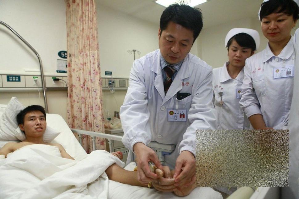 Acest caz a uluit lumea medicală. Ce i-a "crescut" acestui bărbat în PICIOR 239812