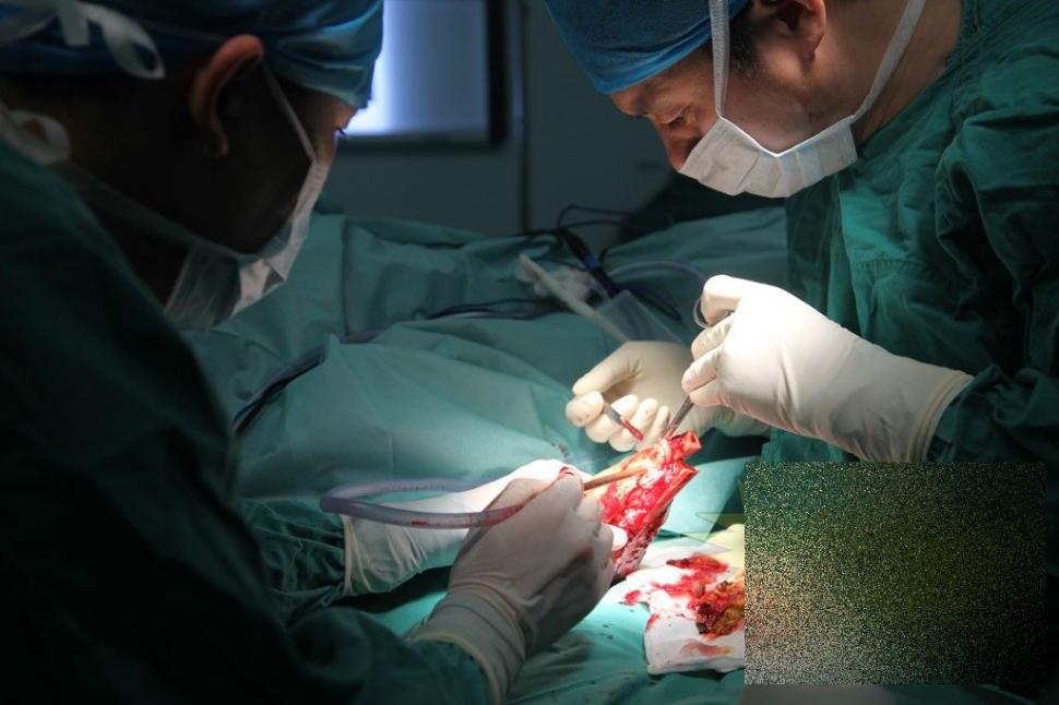 Acest caz a uluit lumea medicală. Ce i-a "crescut" acestui bărbat în PICIOR 239815