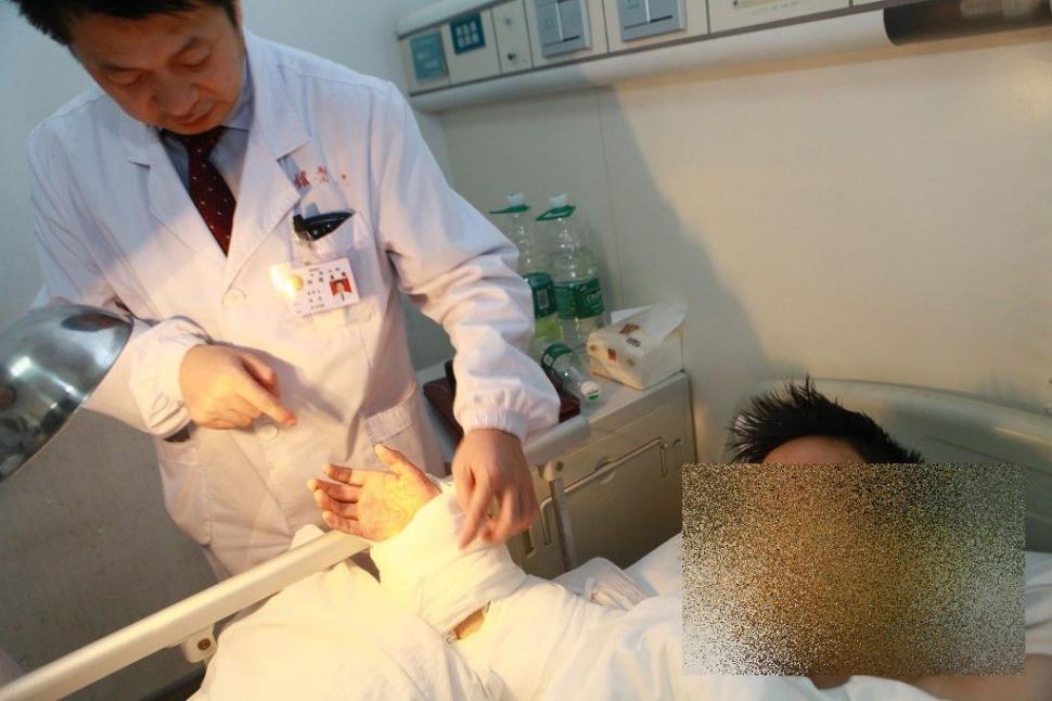 Acest caz a uluit lumea medicală. Ce i-a "crescut" acestui bărbat în PICIOR 239816