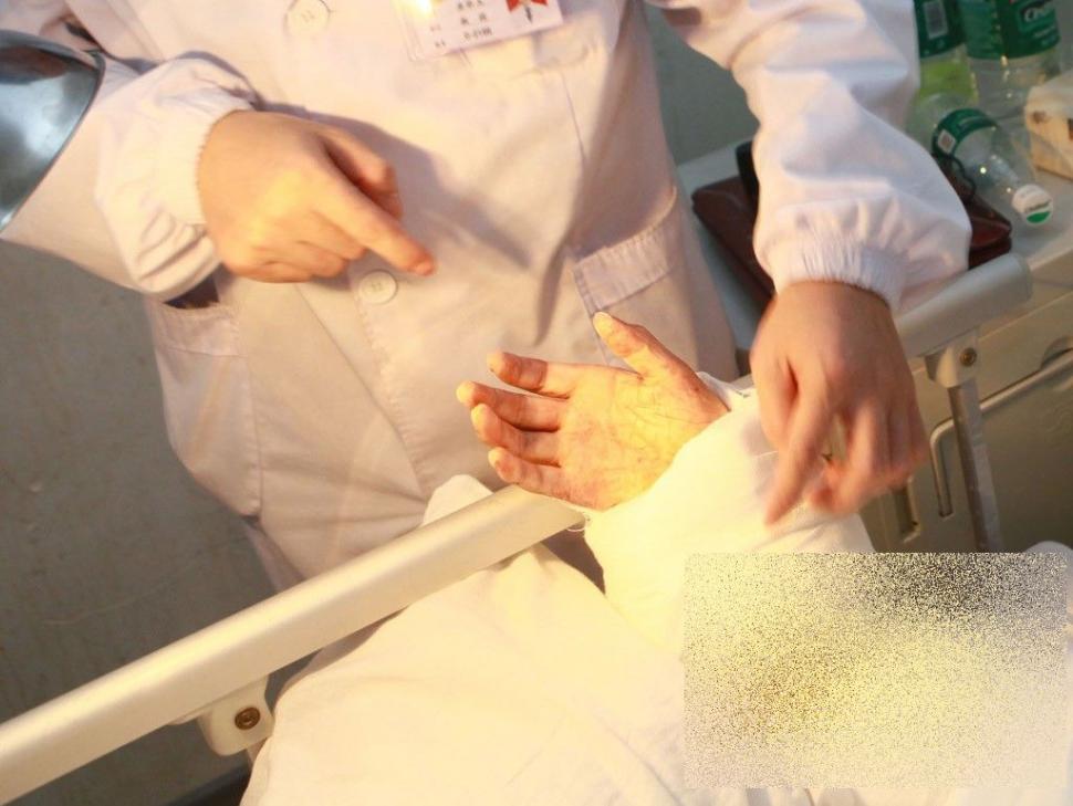 Acest caz a uluit lumea medicală. Ce i-a "crescut" acestui bărbat în PICIOR 239817