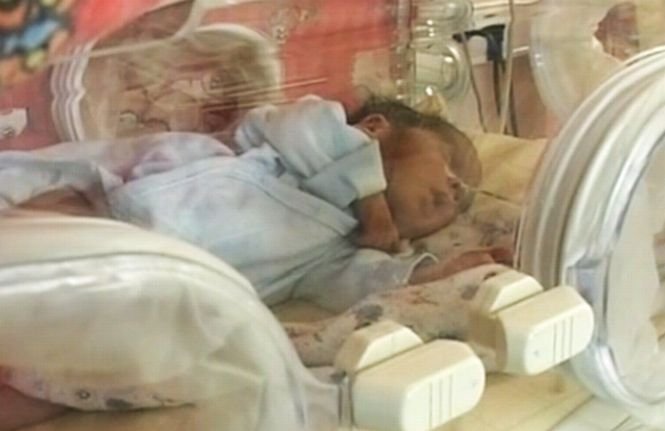 Medicii din Sibiu au înfiinţat o asociaţie pentru salvarea bebeluşilor prematuri