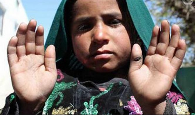 Un copil de 8 ani a încercat să se arunce în aer. Fetiţa a fost prinsă de poliţiştii din Afganistan