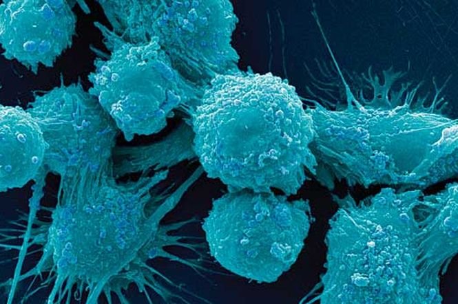 Descoperirea revoluţionară care ar putea scădea considerabil numărul deceselor provocate de cancer