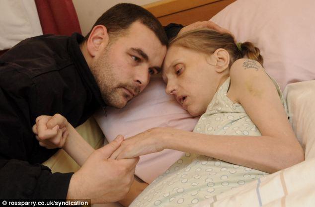 Are 35 de ani, dar arată de 80. Vezi povestea femeii care a băut 40 de BERI pe ZI timp de 15 ani 242837