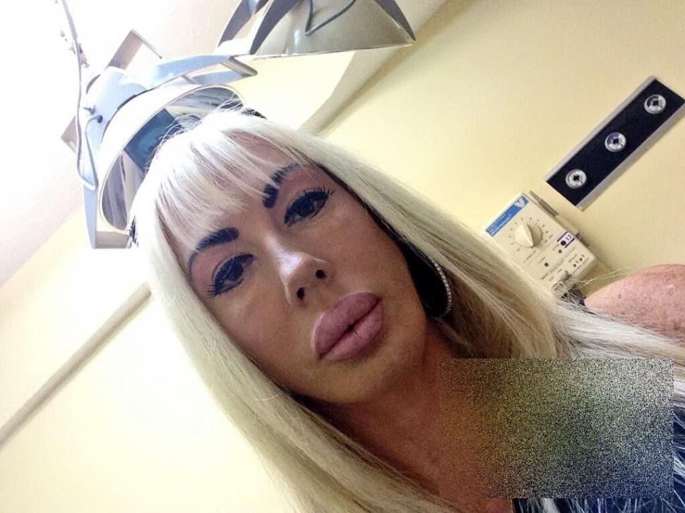 Arată ca un MONSTRU de la gât în jos. "Medicii mi-au distrus viaţa". Cum arată femeia care a dat 200.000 de dolari pe operaţii 243152