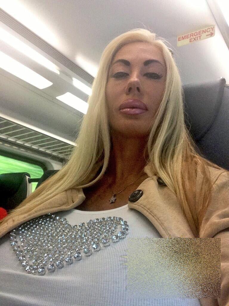 Arată ca un MONSTRU de la gât în jos. "Medicii mi-au distrus viaţa". Cum arată femeia care a dat 200.000 de dolari pe operaţii 243156