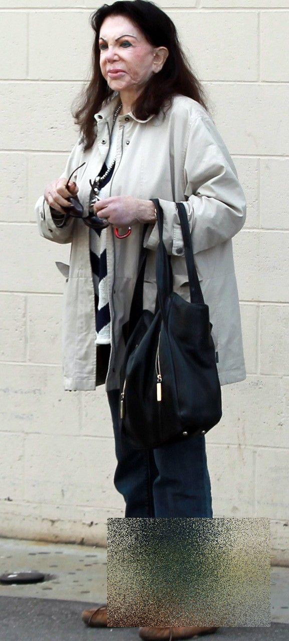 Pur şi simplu îi CADE faţa. Cine este celebra actriţă care şi-a făcut 25 de operaţii estetice într-o ZI 246566