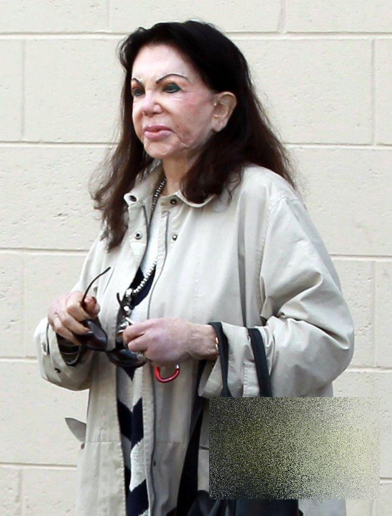 Pur şi simplu îi CADE faţa. Cine este celebra actriţă care şi-a făcut 25 de operaţii estetice într-o ZI 246567