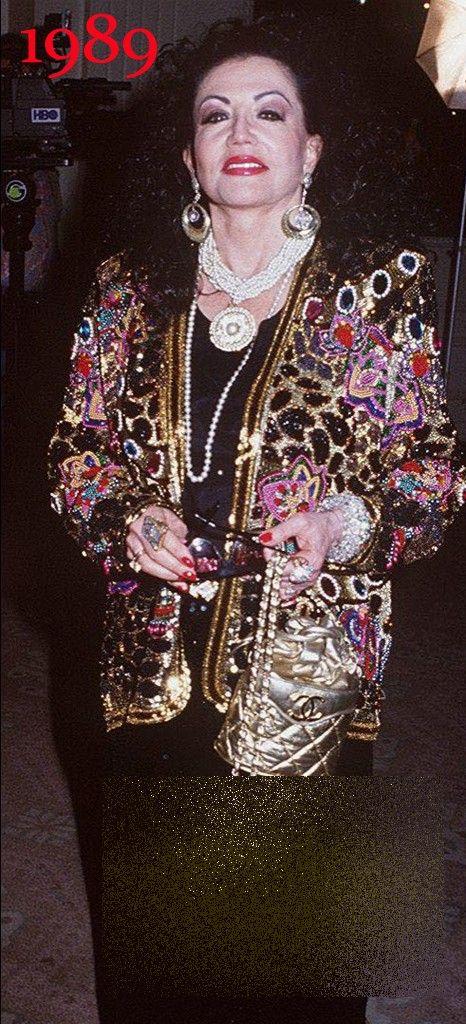 Pur şi simplu îi CADE faţa. Cine este celebra actriţă care şi-a făcut 25 de operaţii estetice într-o ZI 246569