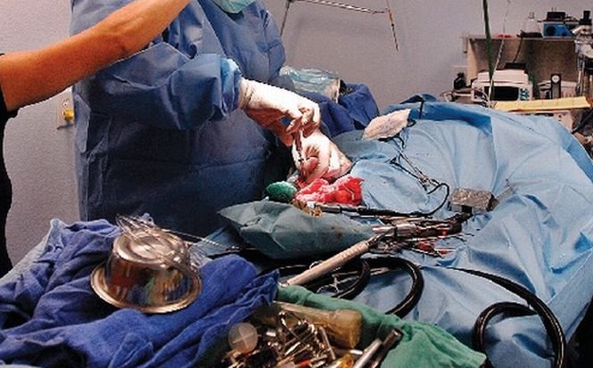Medic acuzat de malpraxis, la Braşov. Un copil a fost operat la piciorul sănătos