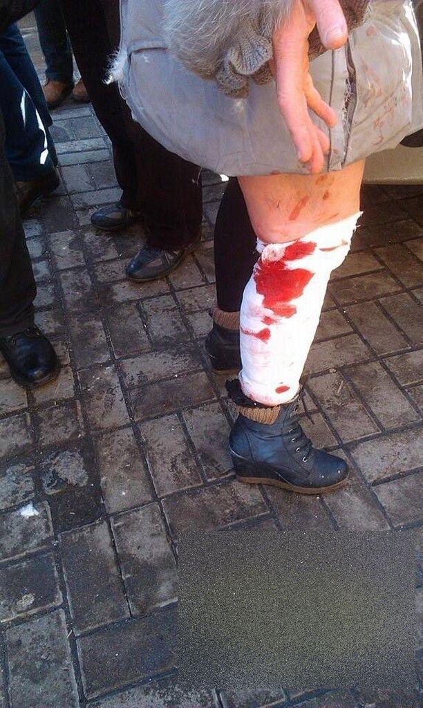 "Dumnezeule, ai milă de sufletele lor!" Imagini CUTREMURĂTOARE postate de protestatarii din Ucraina 247990