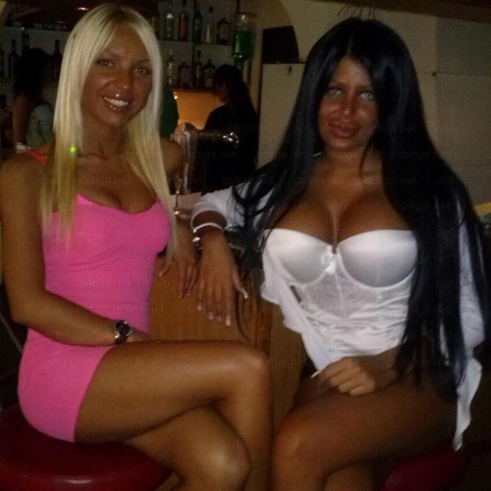 Li se spune "reginele siliconului". Cum arată fetele care nu mai au nicio expresie facială din cauza Botoxului 249035