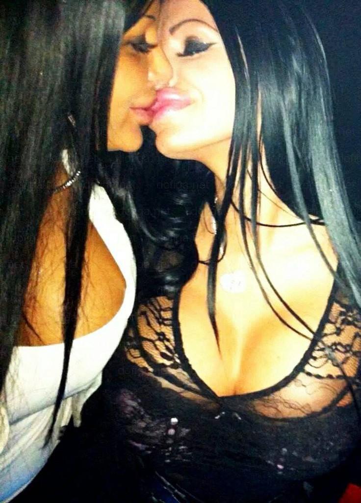 Li se spune "reginele siliconului". Cum arată fetele care nu mai au nicio expresie facială din cauza Botoxului 249036