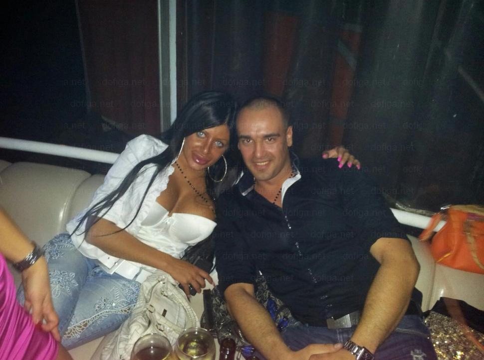 Li se spune "reginele siliconului". Cum arată fetele care nu mai au nicio expresie facială din cauza Botoxului 249039