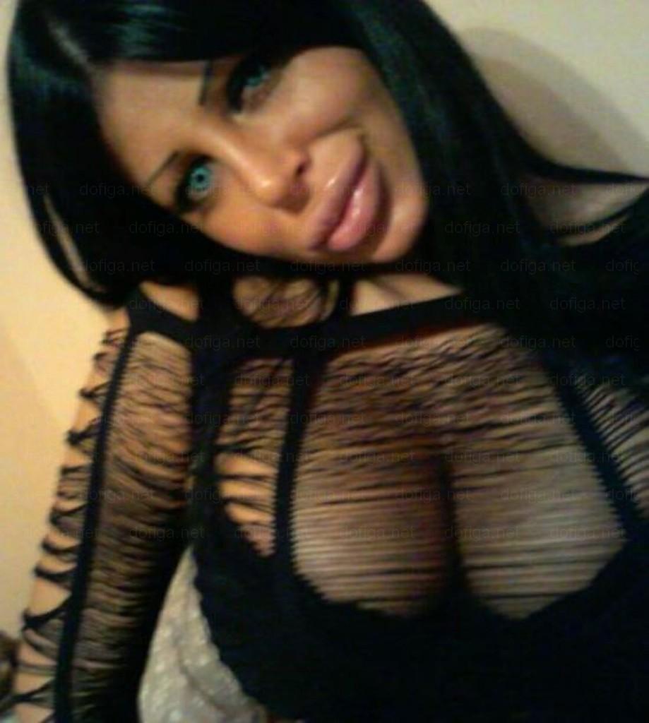 Li se spune "reginele siliconului". Cum arată fetele care nu mai au nicio expresie facială din cauza Botoxului 249044