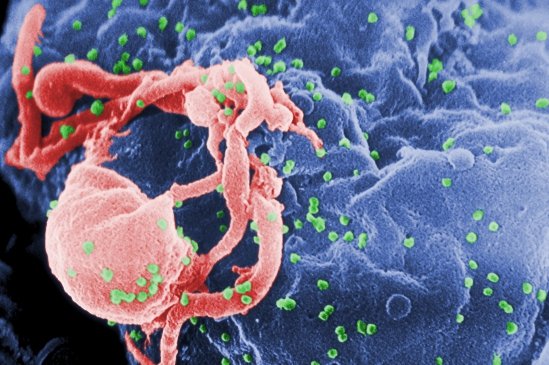 Descoperire colosală care asigură PROTECŢIE contra SIDA