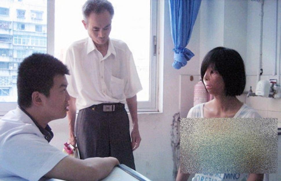 PREMIERĂ ISTORICĂ în lumea medicinei. Cum arată acum această tânără după operaţie 250186