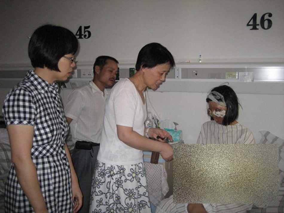 PREMIERĂ ISTORICĂ în lumea medicinei. Cum arată acum această tânără după operaţie 250188