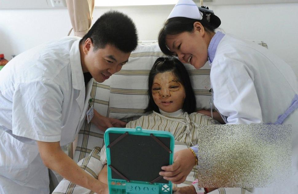 PREMIERĂ ISTORICĂ în lumea medicinei. Cum arată acum această tânără după operaţie 250190