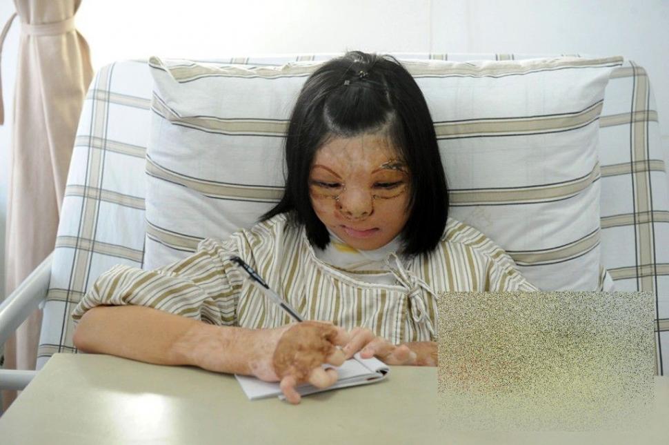 PREMIERĂ ISTORICĂ în lumea medicinei. Cum arată acum această tânără după operaţie 250192