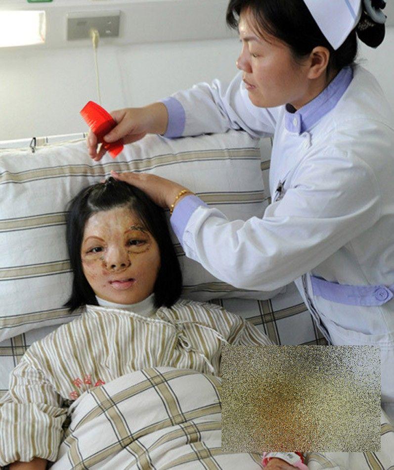 PREMIERĂ ISTORICĂ în lumea medicinei. Cum arată acum această tânără după operaţie 250193