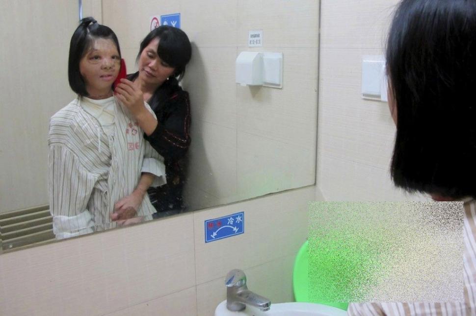 PREMIERĂ ISTORICĂ în lumea medicinei. Cum arată acum această tânără după operaţie 250195