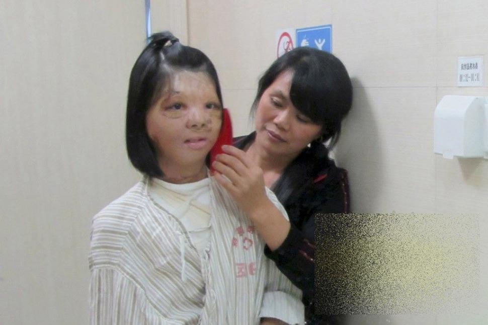 PREMIERĂ ISTORICĂ în lumea medicinei. Cum arată acum această tânără după operaţie 250196