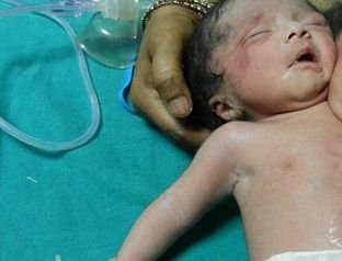 Medicii i-au spus că are o sarcină NORMALĂ, însă când a născut a avut parte de un şoc