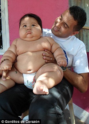 Imagini incredibile cu cel mai gras bebeluş. Cântarul s-a oprit la 21 de kilograme. Micuţul are doar 8 luni de viaţă