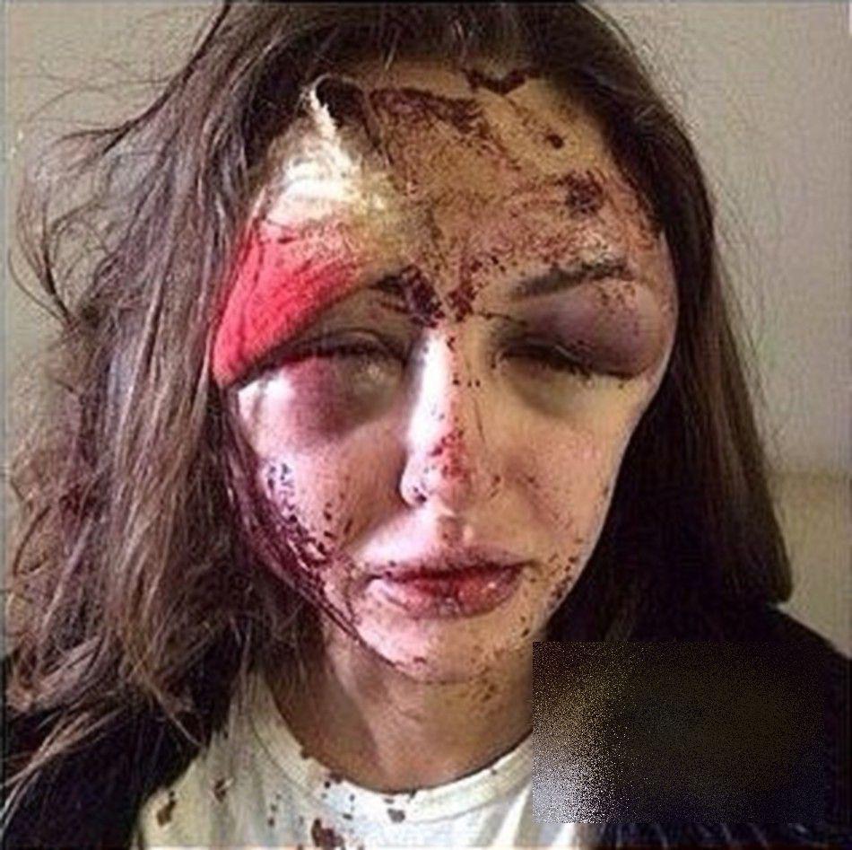 Ce i-a făcut acestei SUPERBE tinere un apropiat de-al lui Vladimir Putin. Nici părinţii n-au mai recunoscut-o 252827