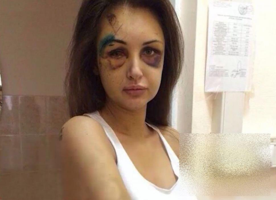 Ce i-a făcut acestei SUPERBE tinere un apropiat de-al lui Vladimir Putin. Nici părinţii n-au mai recunoscut-o 252832