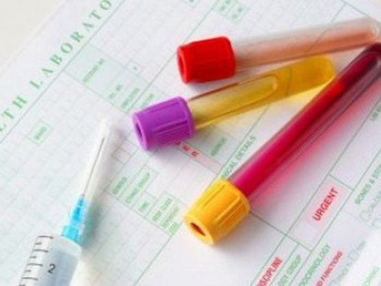Descoperire uluitoare: Un simplu test de sânge poate depista CANCERUL