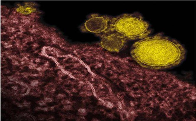 MERS se EXTINDE rapid în Orientul Mijlociu. Autorităţile sunt acuzate că au scăpat de sub control EPIDEMIA MORTALĂ