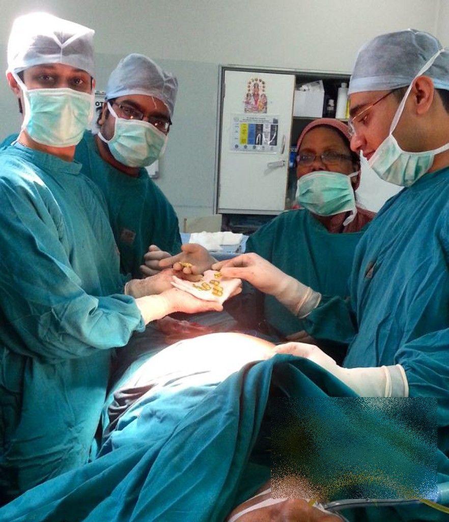 Ce au găsit chirurgii în STOMACUL unui om de afaceri. "N-am văzut în viaţa noastră aşa ceva" 256926