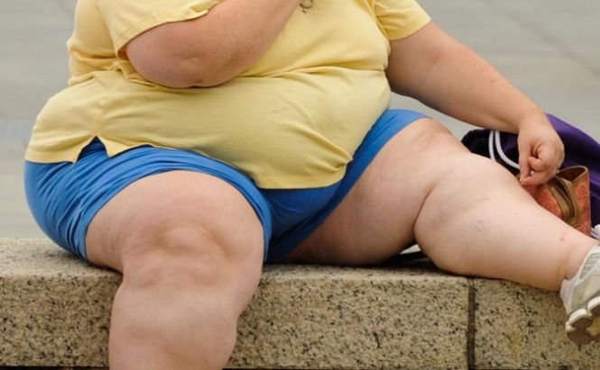 Raport OMS: Peste un miliard de adulţi sunt supraponderali la nivel mondial. România, cel mai mic procent de obezi
