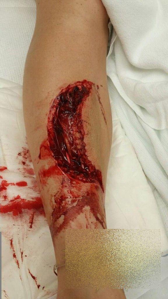 Este cea mai norocoasă femeie. Cum arată după ce a fost SFÂŞIATĂ de un RECHIN 262537