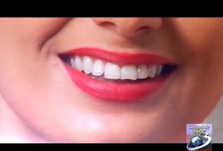 NUMAI DE BINE: Cum să avem dinţii mai albi