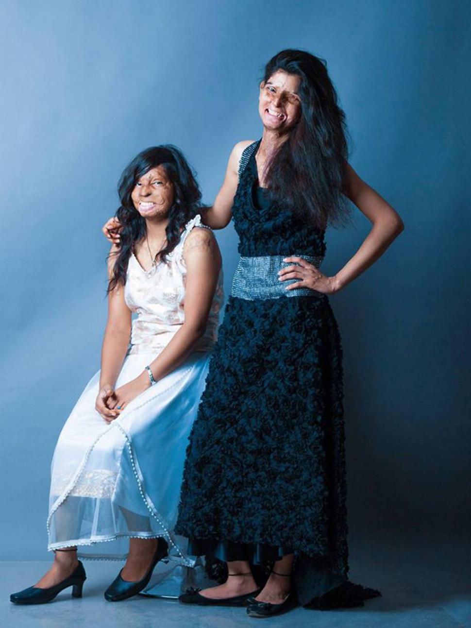 Toate aceste femei au fost desfigurate în urma atacurilor cu acid. Acum zâmbesc într-un pictorial inedit 271625