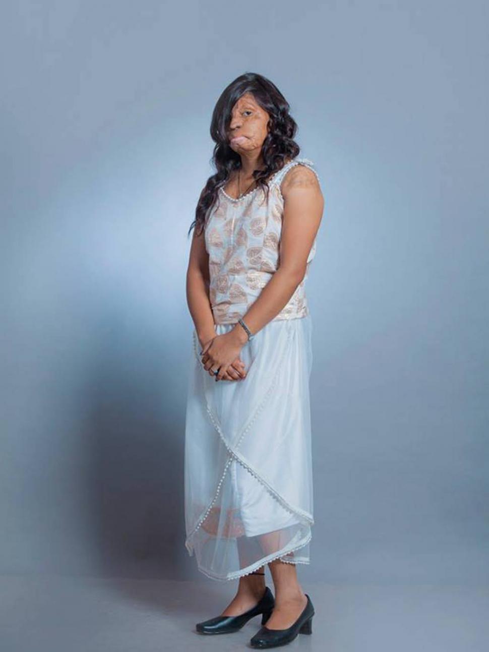 Toate aceste femei au fost desfigurate în urma atacurilor cu acid. Acum zâmbesc într-un pictorial inedit 271626